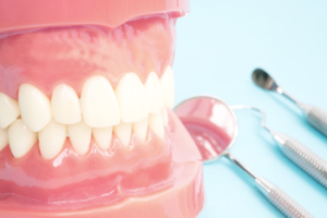 dental impression materials buderim